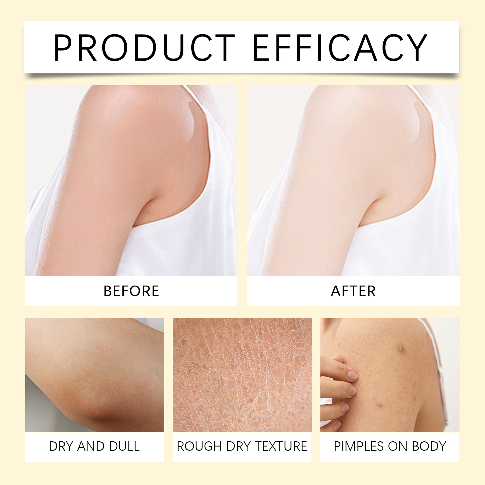 South Moon Bee Venom Cream Before After Results